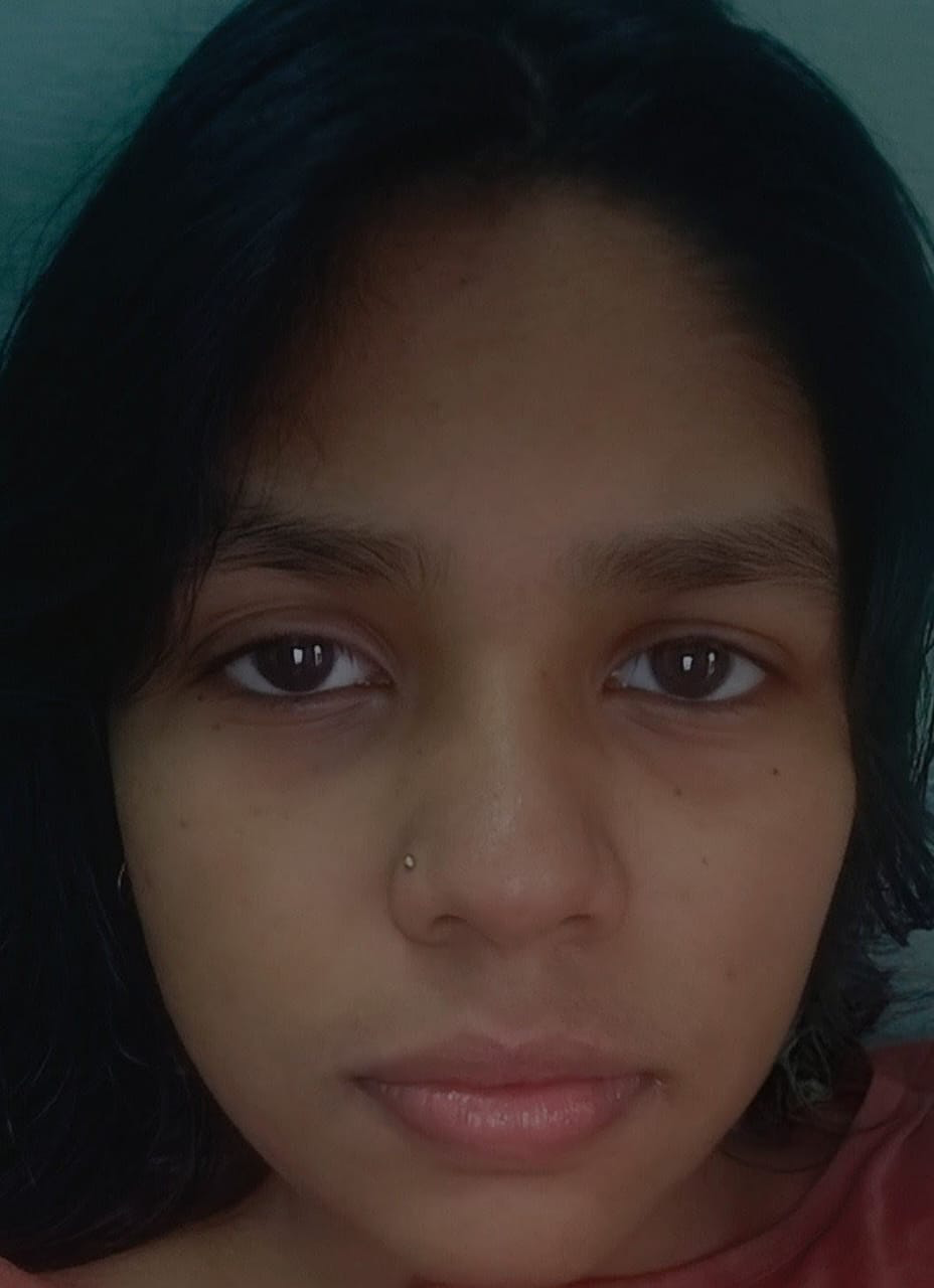 Sneha