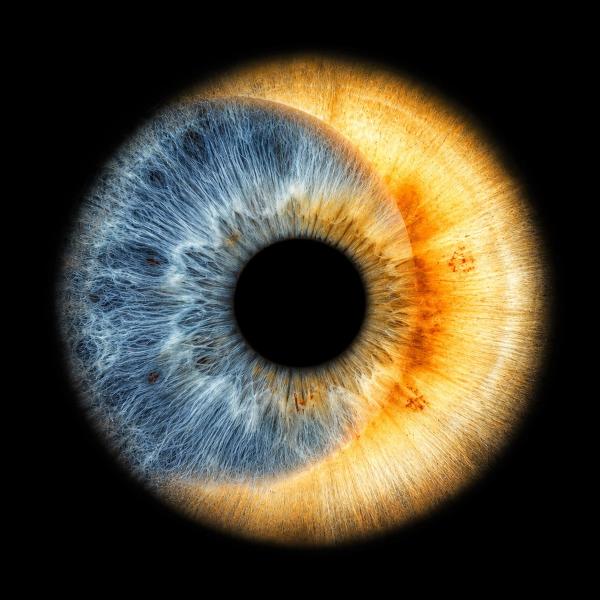 Due iridi unite come un’eclissi