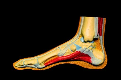Cover Image for Managing Achilles Pain Before Race Day
