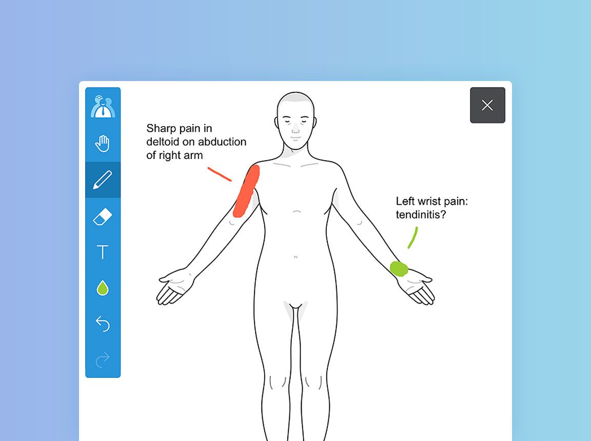 Human body illustration with annotations.