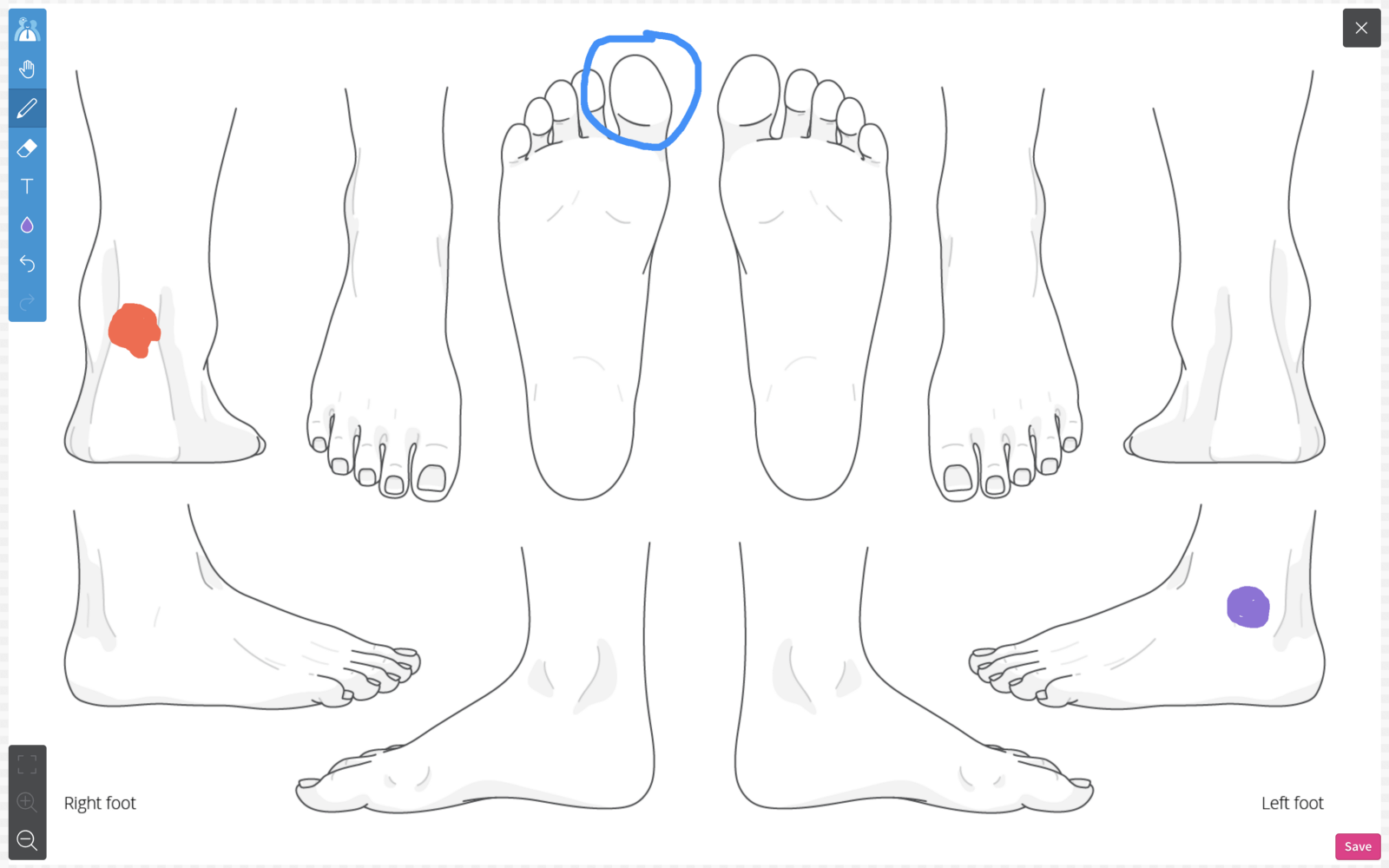 Foot Diagrams, Privacy Policy in Data Export, and Xero changes