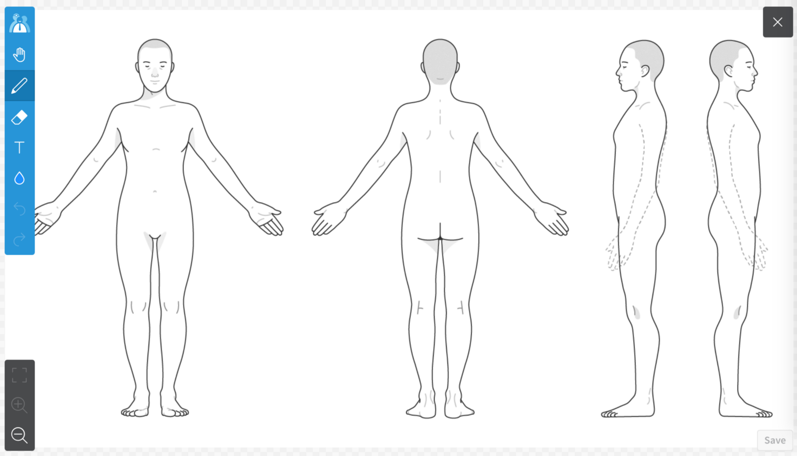 A body chart before markup.