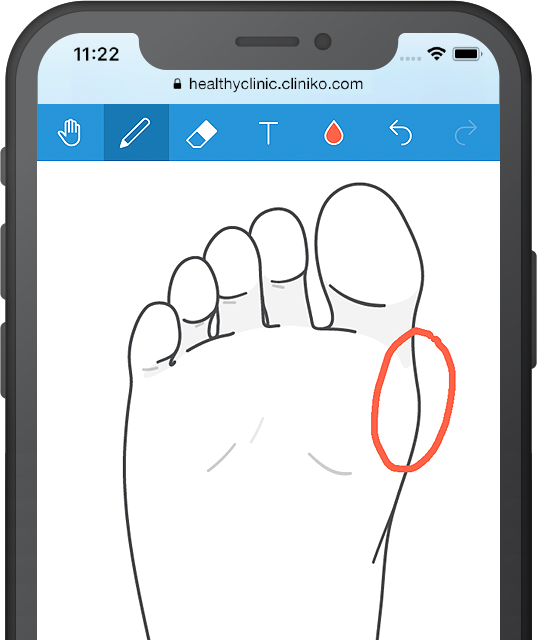 Mobile phone displaying a foot diagram in Cliniko.