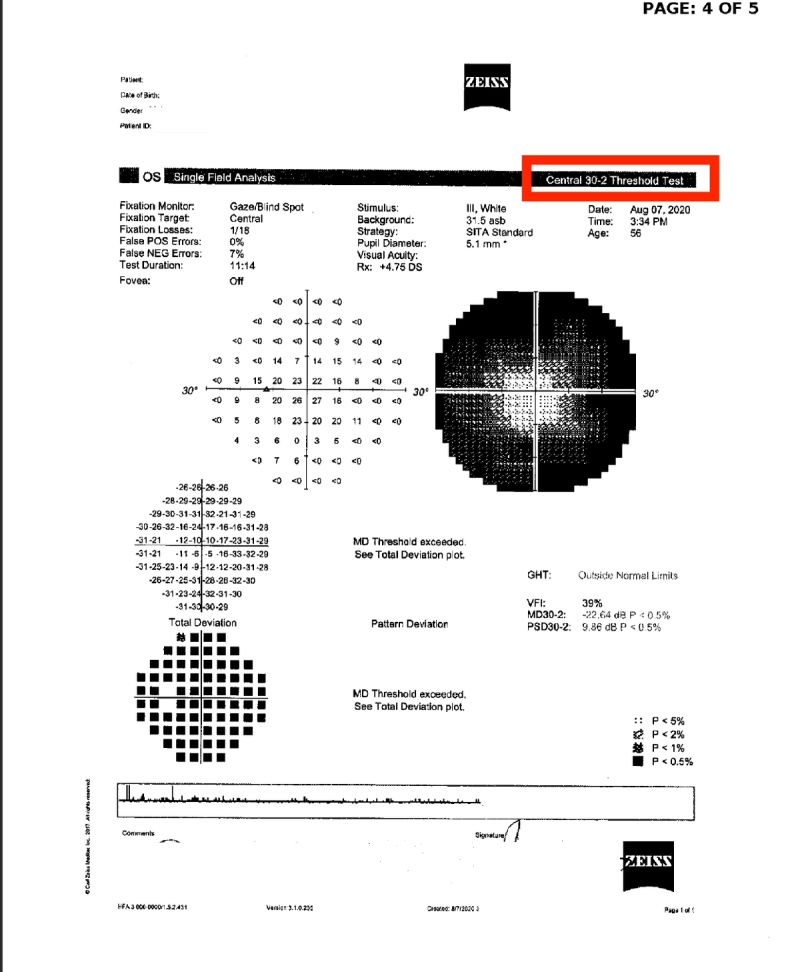 Humphrey 30-2 test results