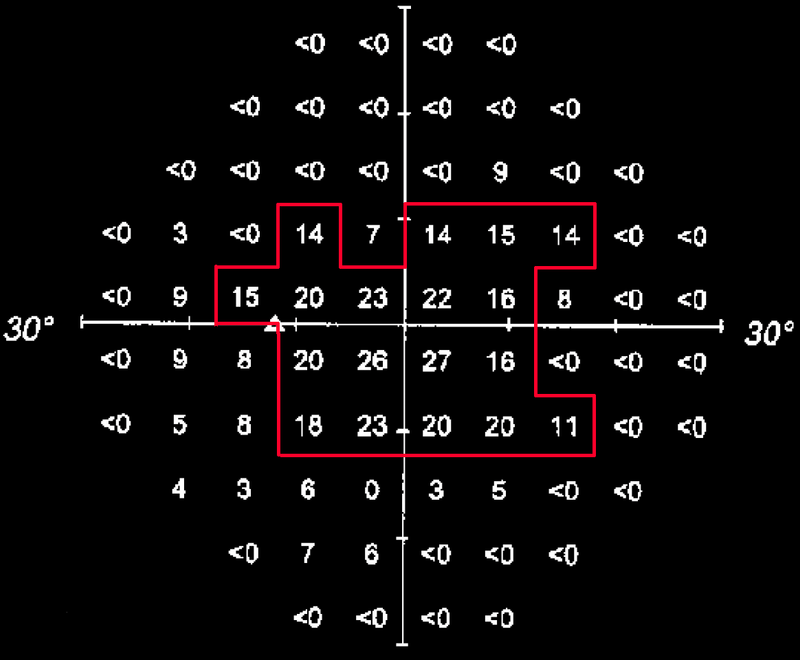 Boxed off seeing area