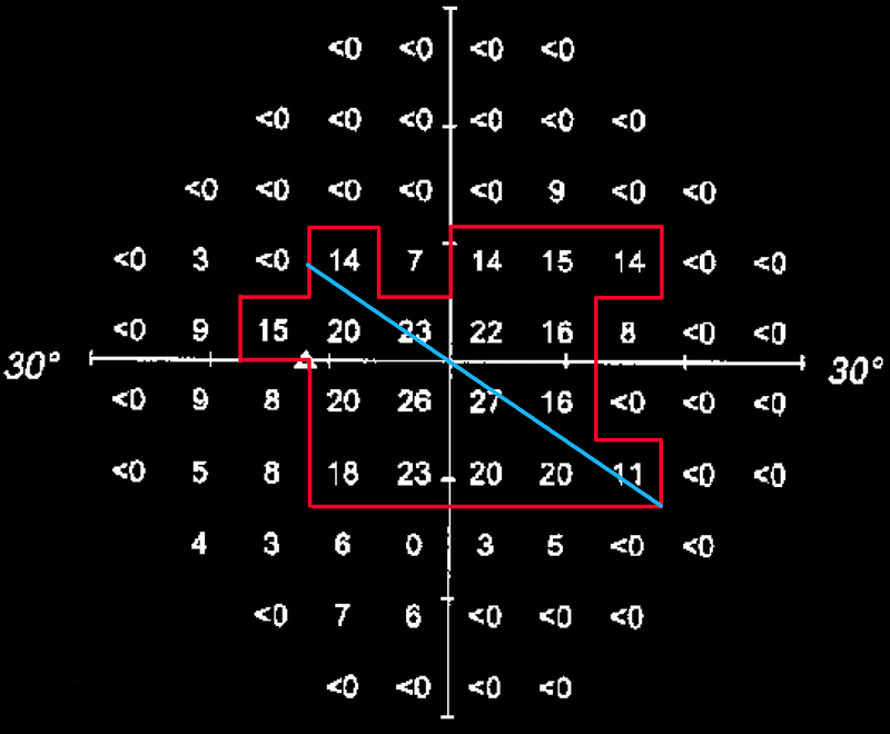 Widest diameter line
