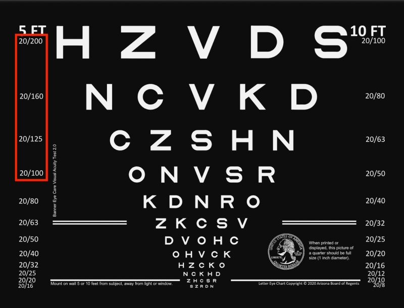 Bailey-Lovie eye chart