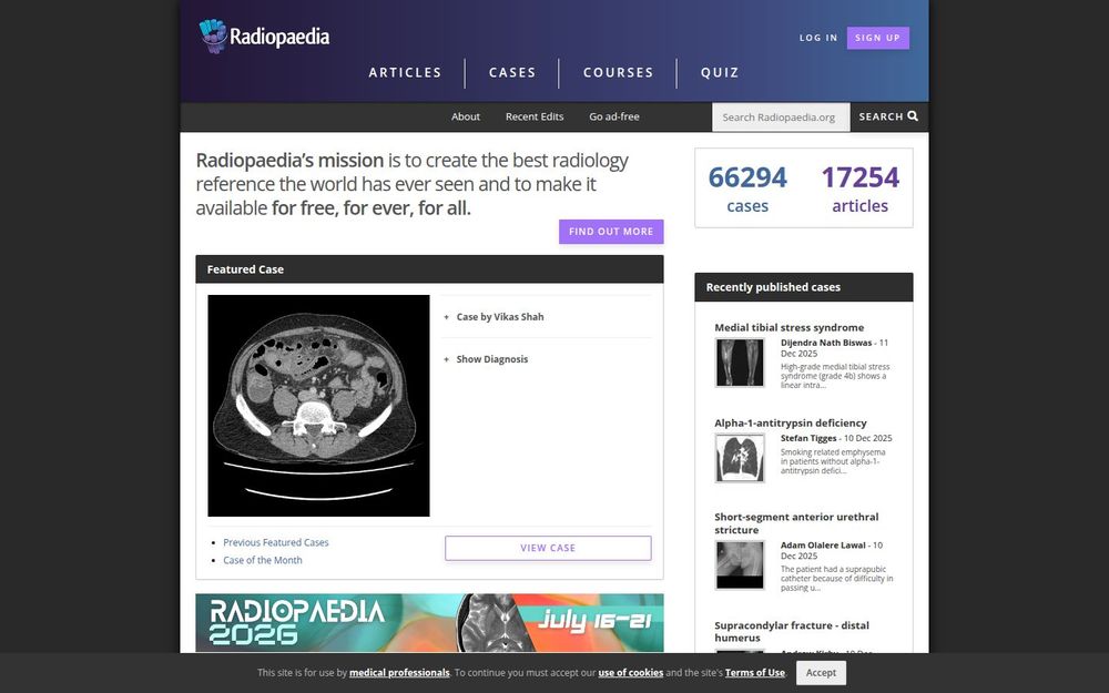 image of Radiopaedia image of Radiopaedia