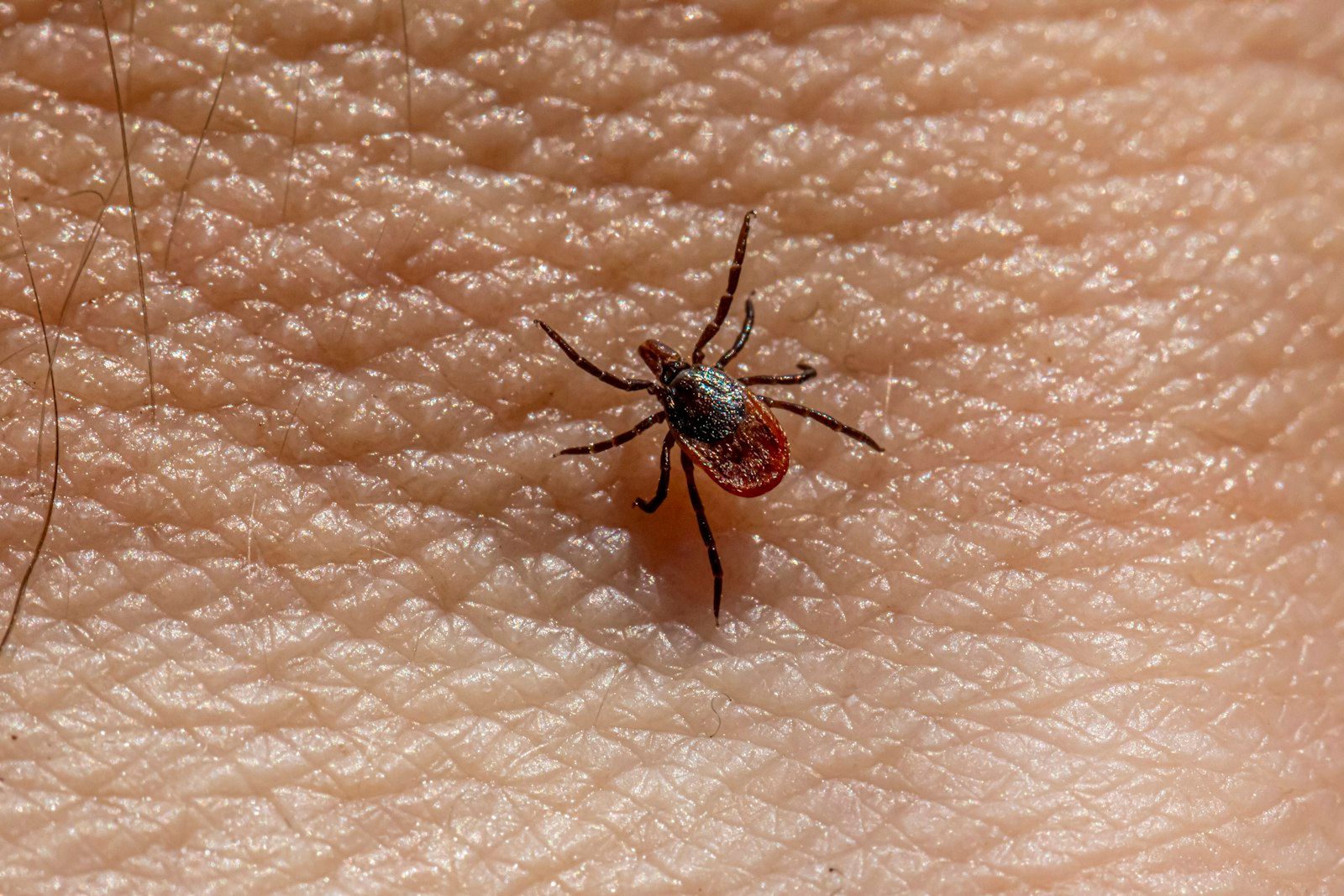 a close up of a person's skin with a spider on it