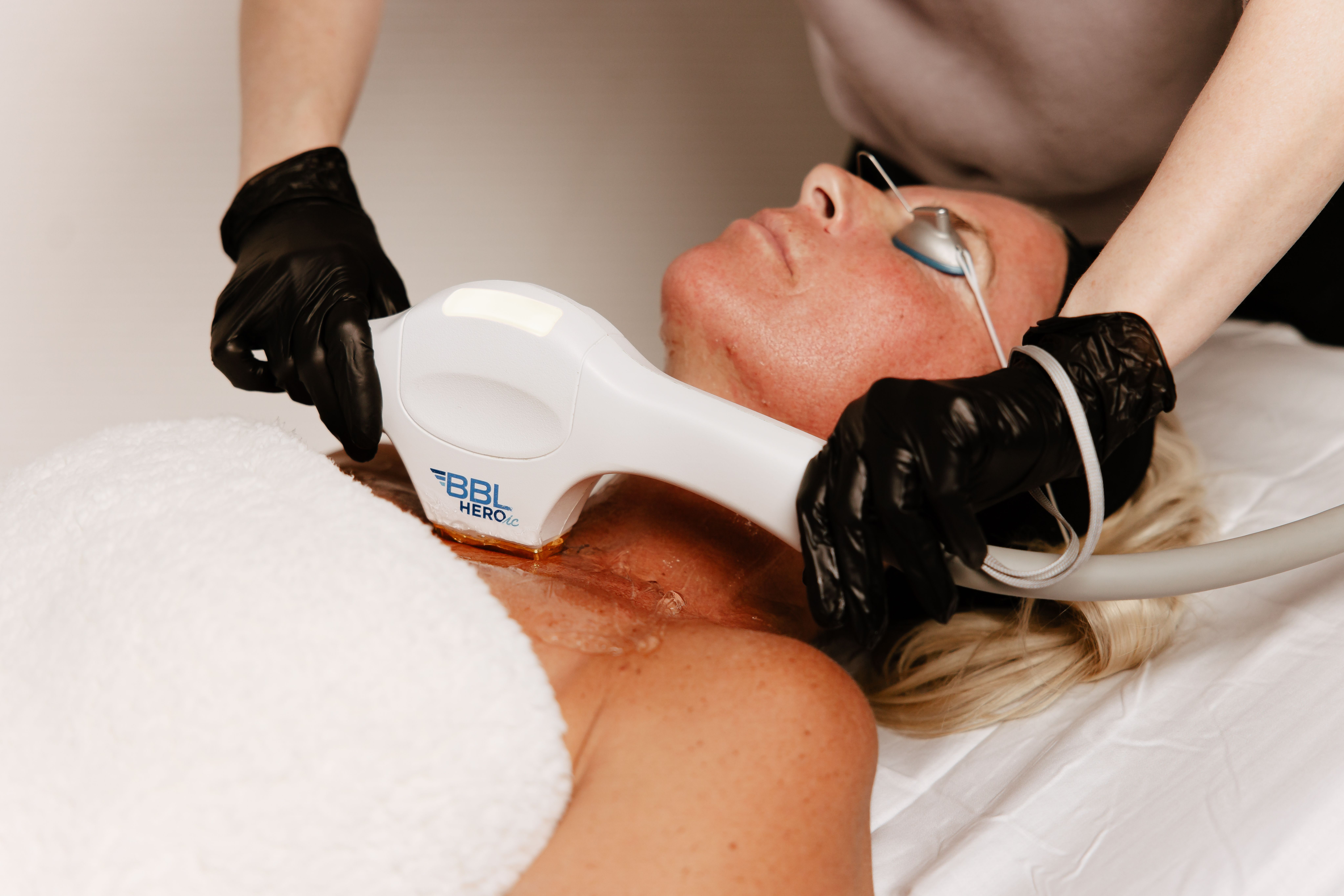 Laser Treatments treatment at Boujee Nurse Denver