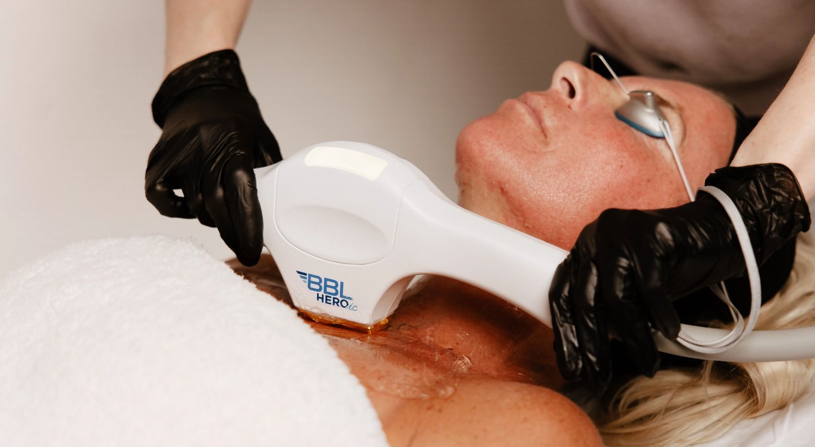 Laser Treatments treatment at Boujee Nurse Denver