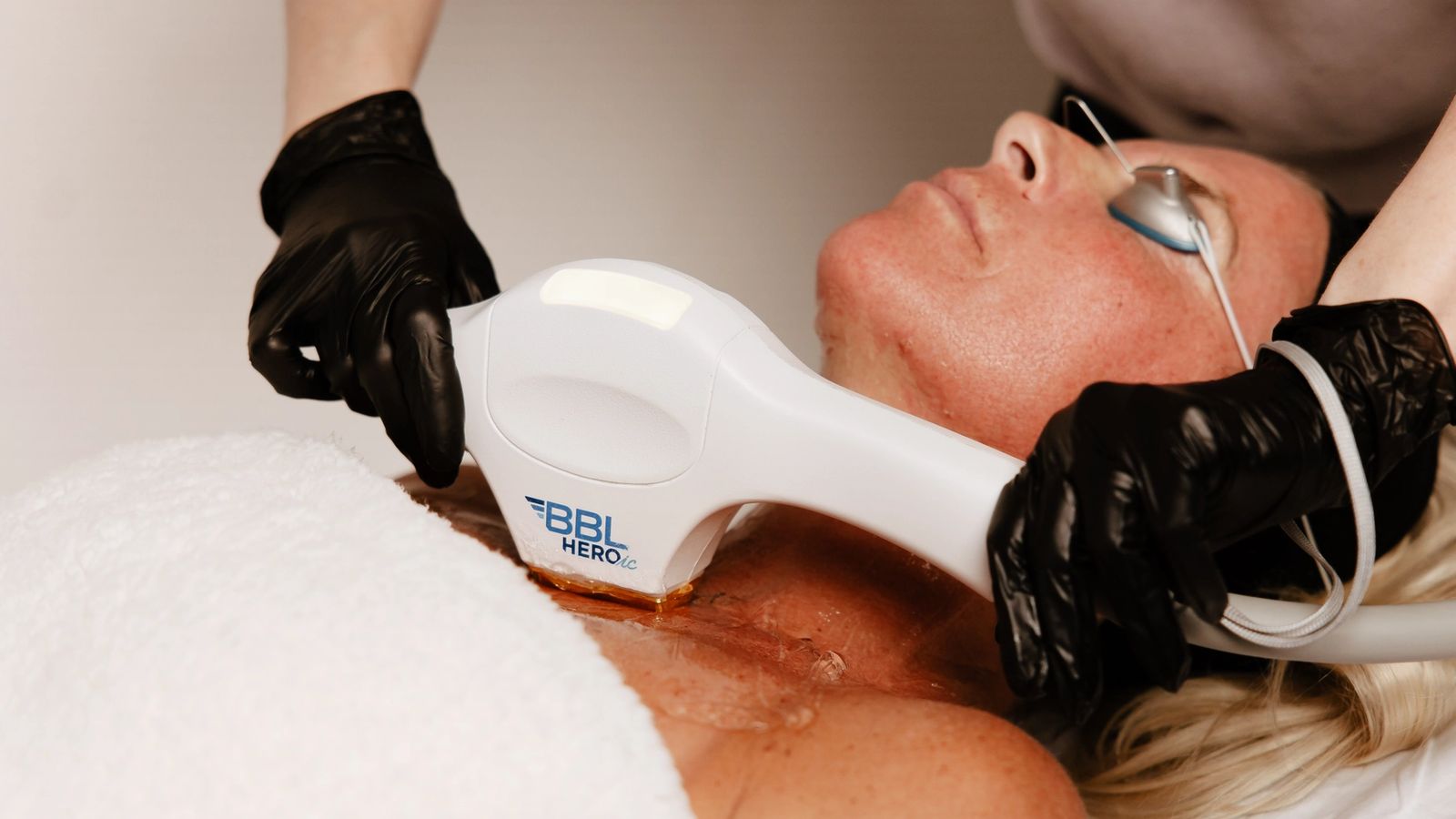 Laser Treatments treatment at Boujee Nurse Denver