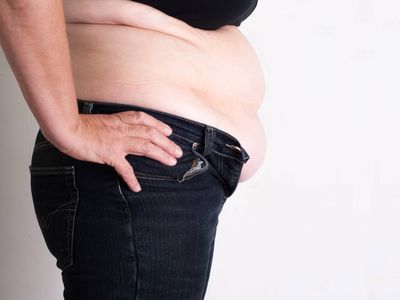 Quel est le lien entre obésité et hypertension ?