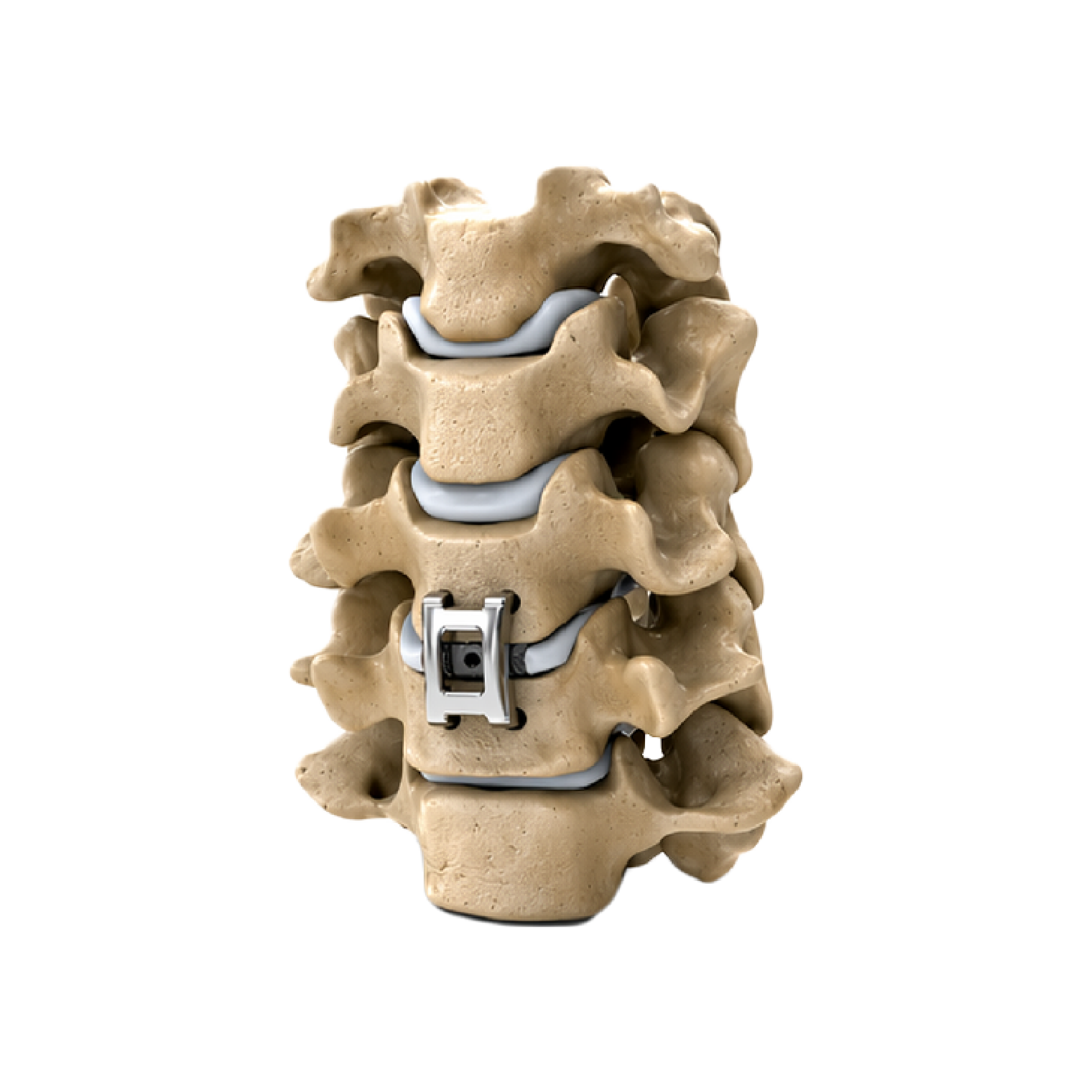 Pressio Spine