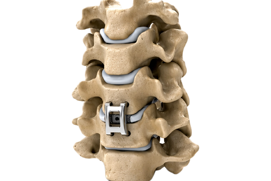 Pressio Spine