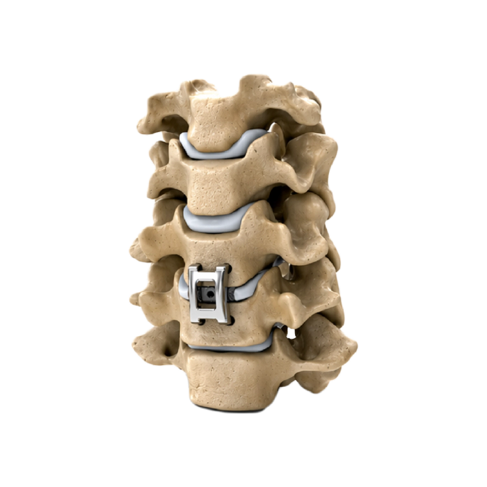 Pressio Spine