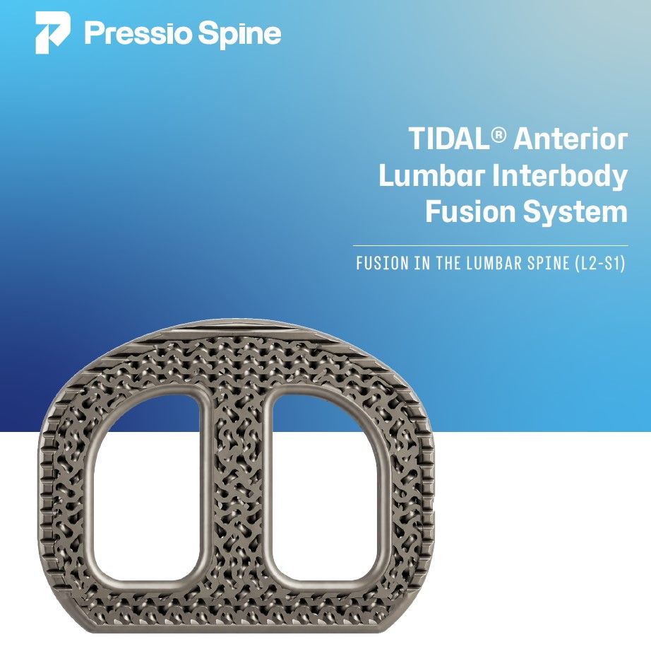 Development of Continuous Compression Lumbar Platform Hits Key Milestone