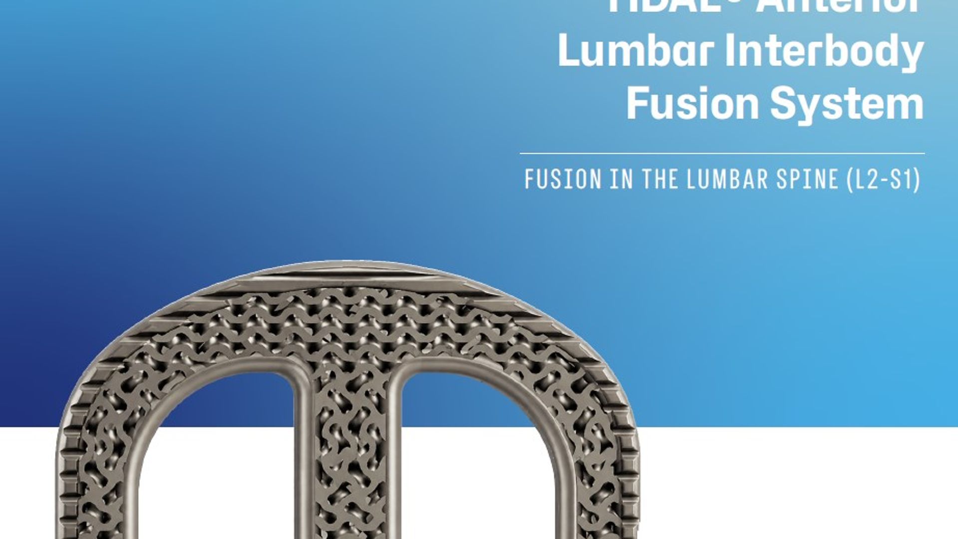 Development of Continuous Compression Lumbar Platform Hits Key Milestone