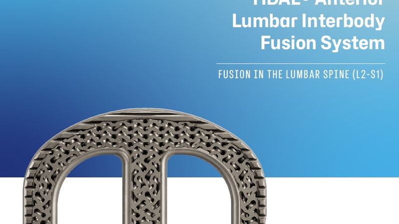 Development of Continuous Compression Lumbar Platform Hits Key Milestone