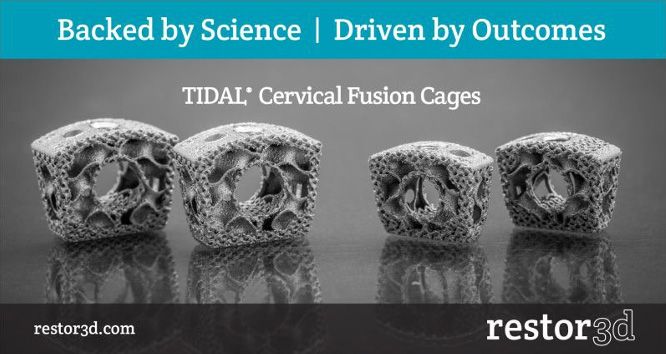 Acquisition of restor3d Cervical and Lumbar Implant Systems