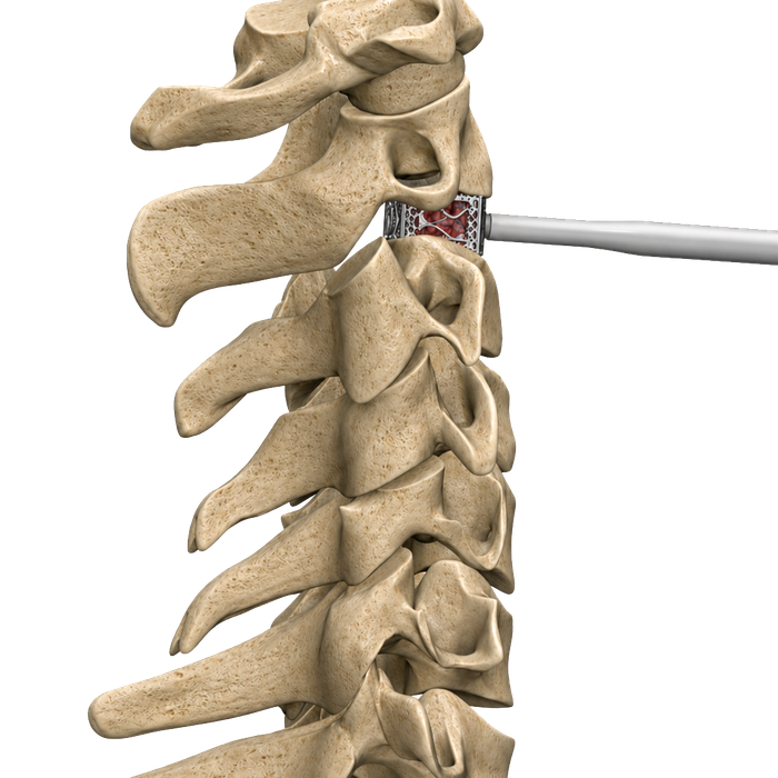 PressioSpine_TIDAL_Cervical