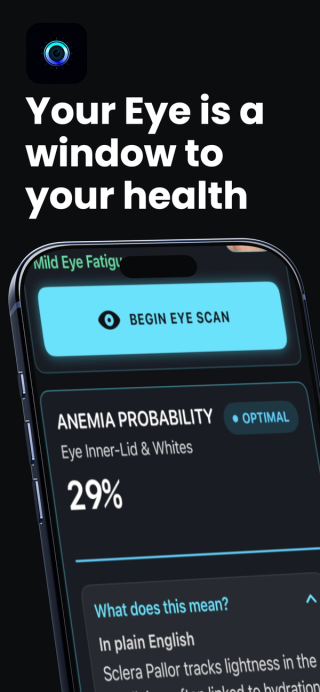 Your eye is a window to your health