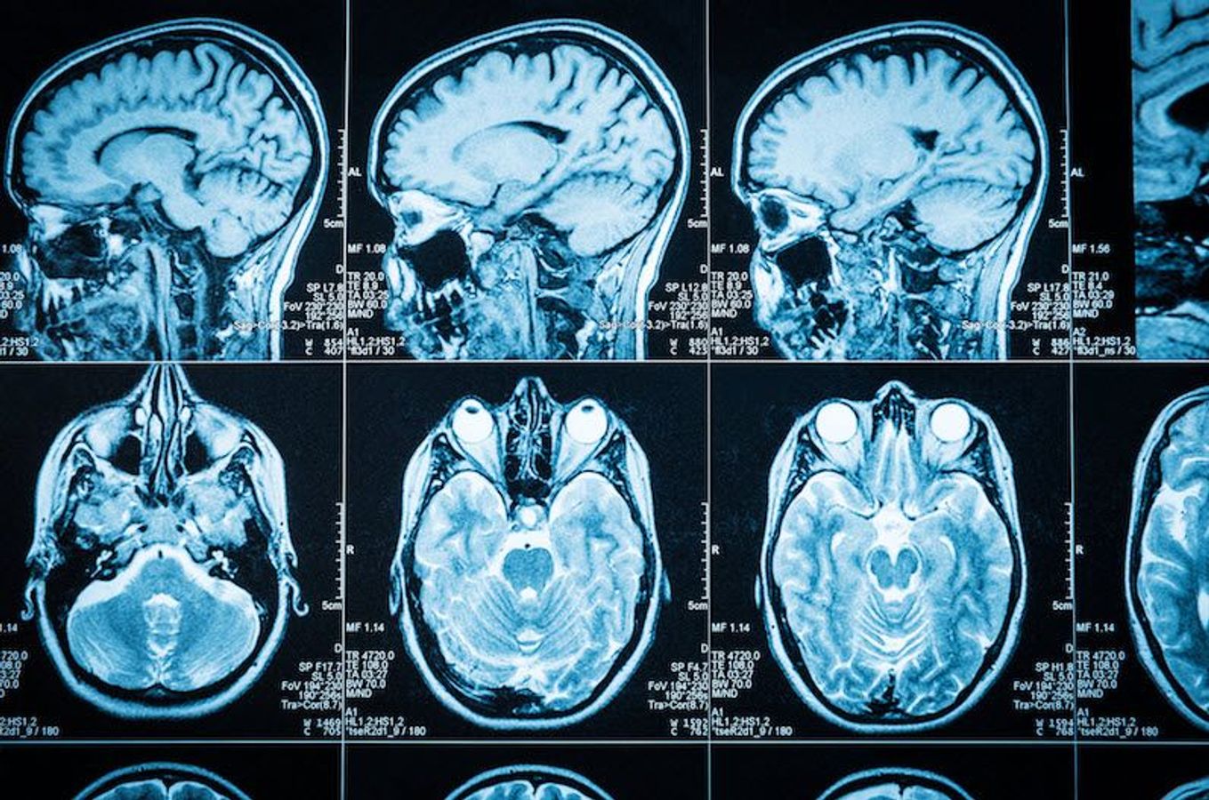 How Brain Imaging Can Help Us Work Better, Together