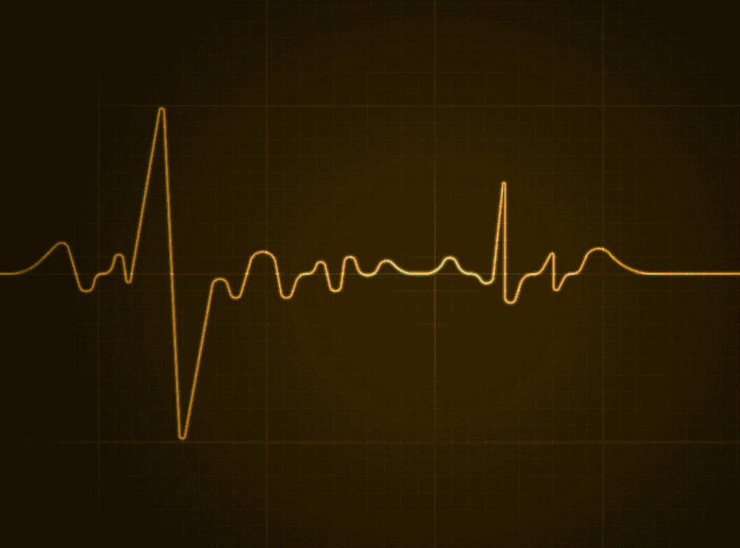 Cyber pitchdeck — afbeelding 14