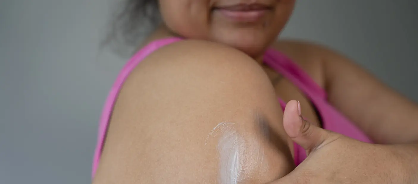 What Makes Lume Acidified Body Cream Such A Treat For Your Skin?