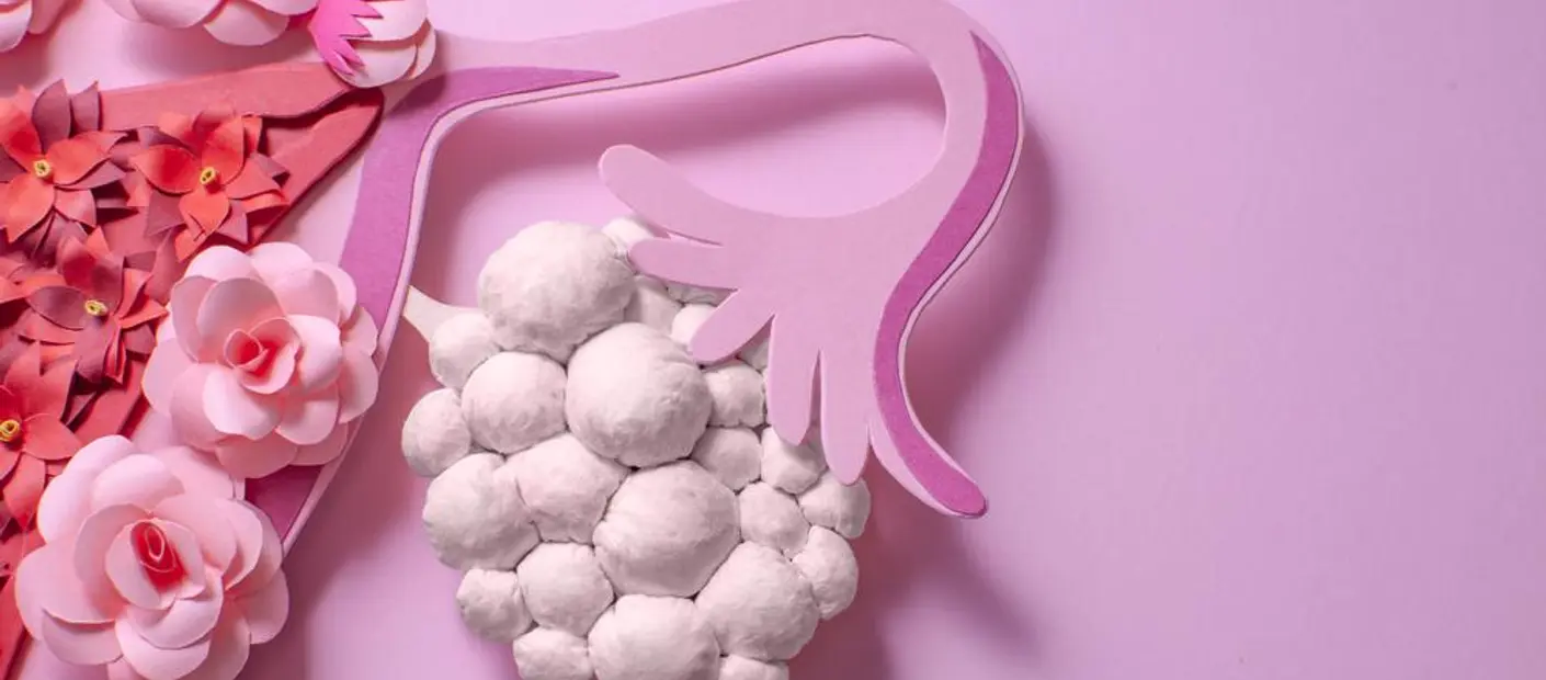 What Is Polycystic Ovarian Syndrome (PCOS) and How Does It Affect Body Odor?