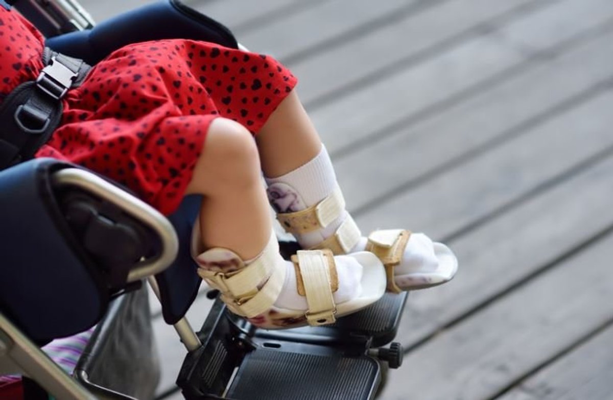 Child seated in an adaptive chair wearing ankle-foot orthotic braces