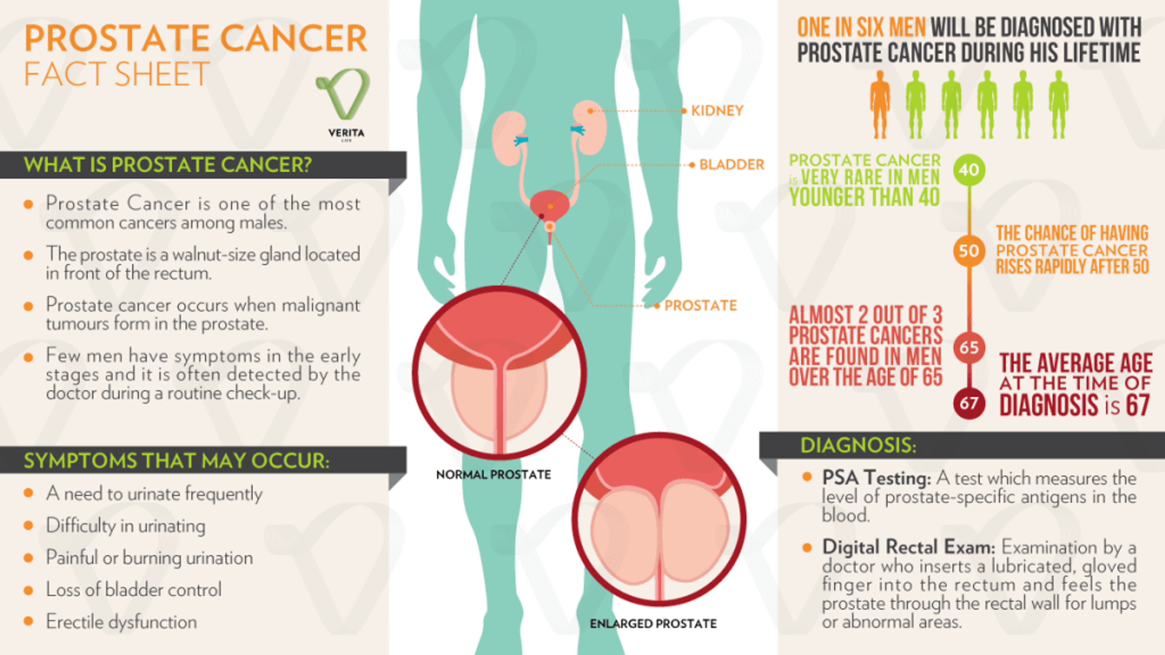 Prostate cancer infographic from the original article