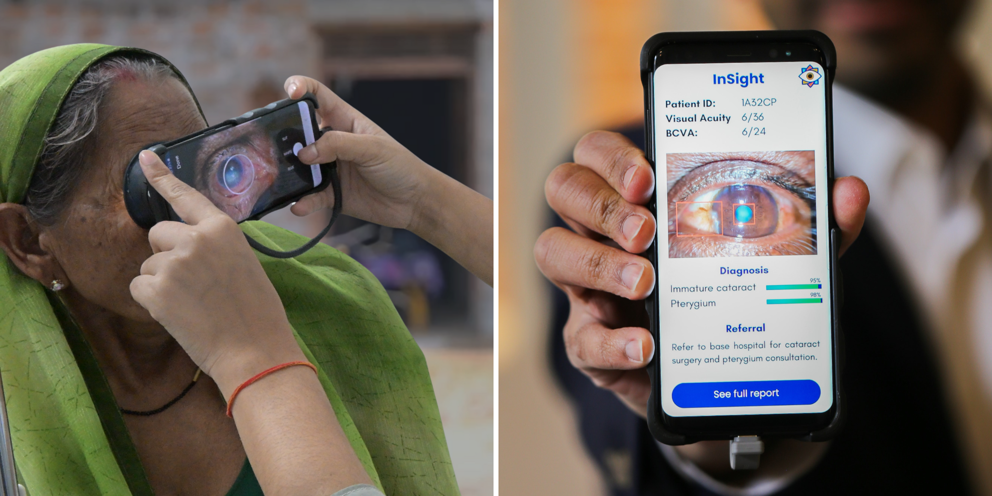 Dr. Nakul Shekhawat and Jordan Shuff Are Using AI to Restore Sight – Fast Forward