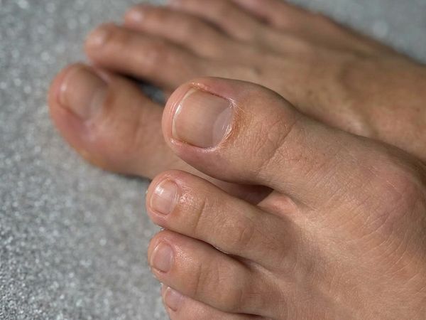 Pedicura Masculina