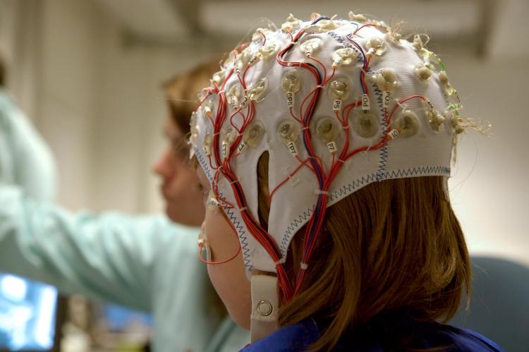 New Epilepsy Treatment for Children: Clinical Trials Driving Breakthrough Therapiesimage