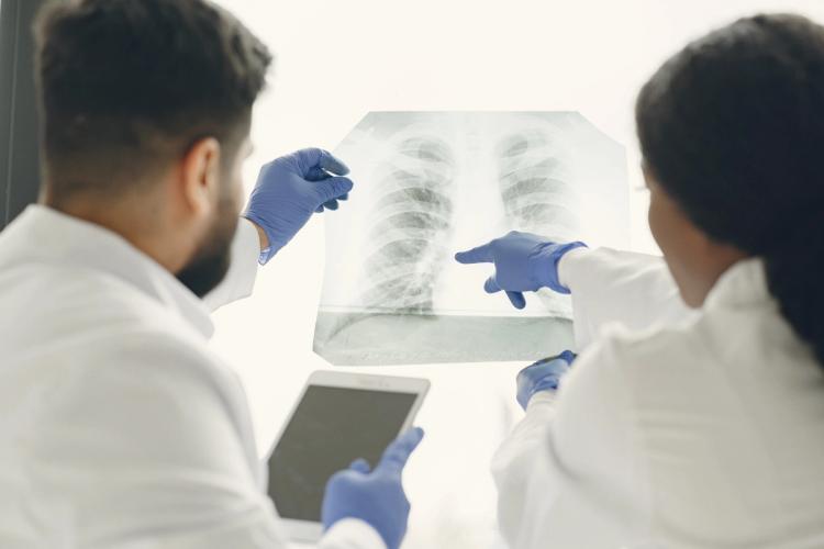 Lung Cancer Treatment: Why Gene Testing Now Matters as Much as Stageimage