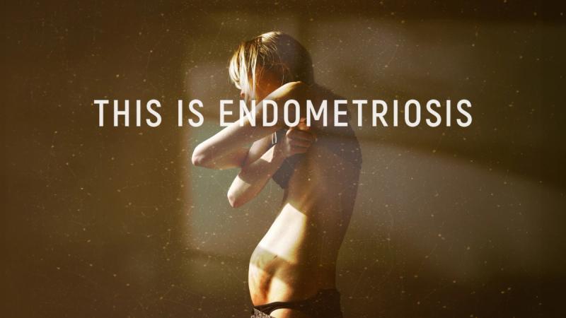 Watch This Is Endometriosis