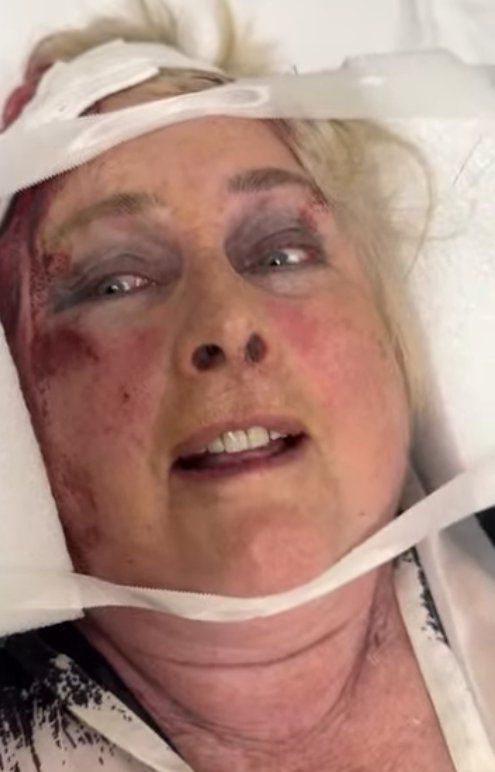 Binky Felstead's mum shares alarming video strapped to hospital bed with blood down her face