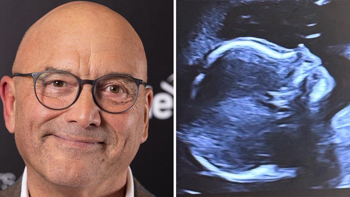Gregg Wallace fans warn TV star about post revealing he's going to be a grandfather — Movies news on dripviewz