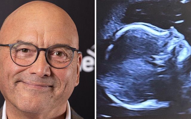 Gregg Wallace fans warn TV star about post revealing he's going to be a grandfather — Movies story on dripviewz