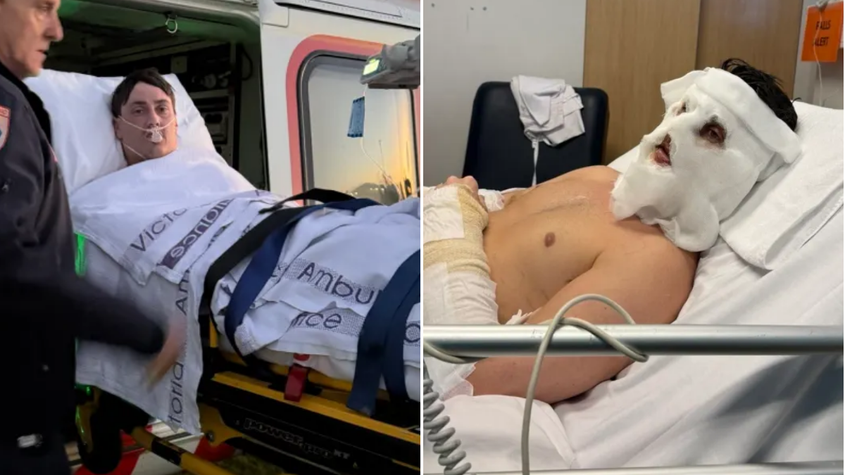 Doctors discover bleed on TV star's brain after he falls into a bonfire