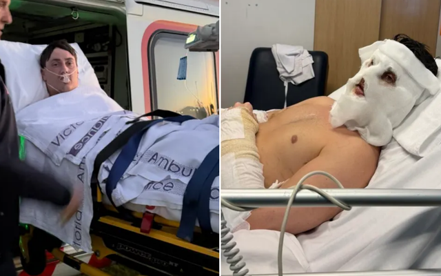 Doctors discover bleed on TV star's brain after he falls into a bonfire