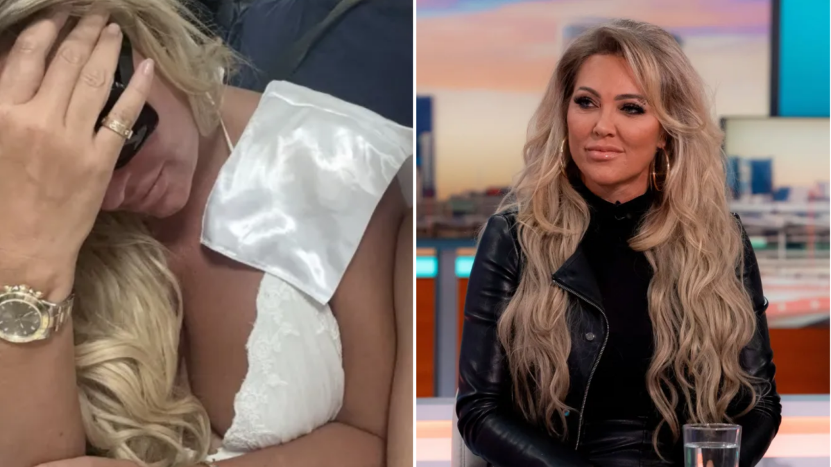 Reality star 'scarred for life' after being mauled by XL Bully — Reality Tv news on dripviewz