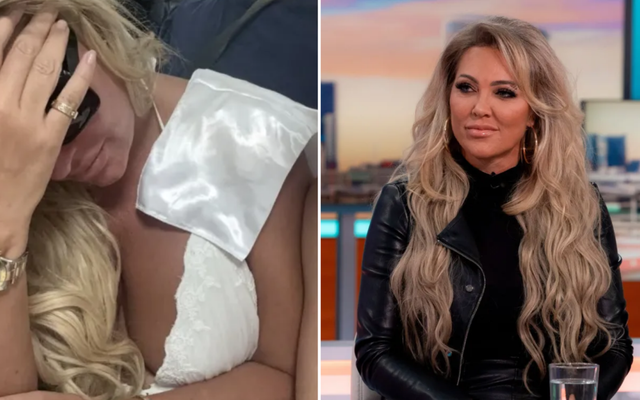Reality star 'scarred for life' after being mauled by XL Bully