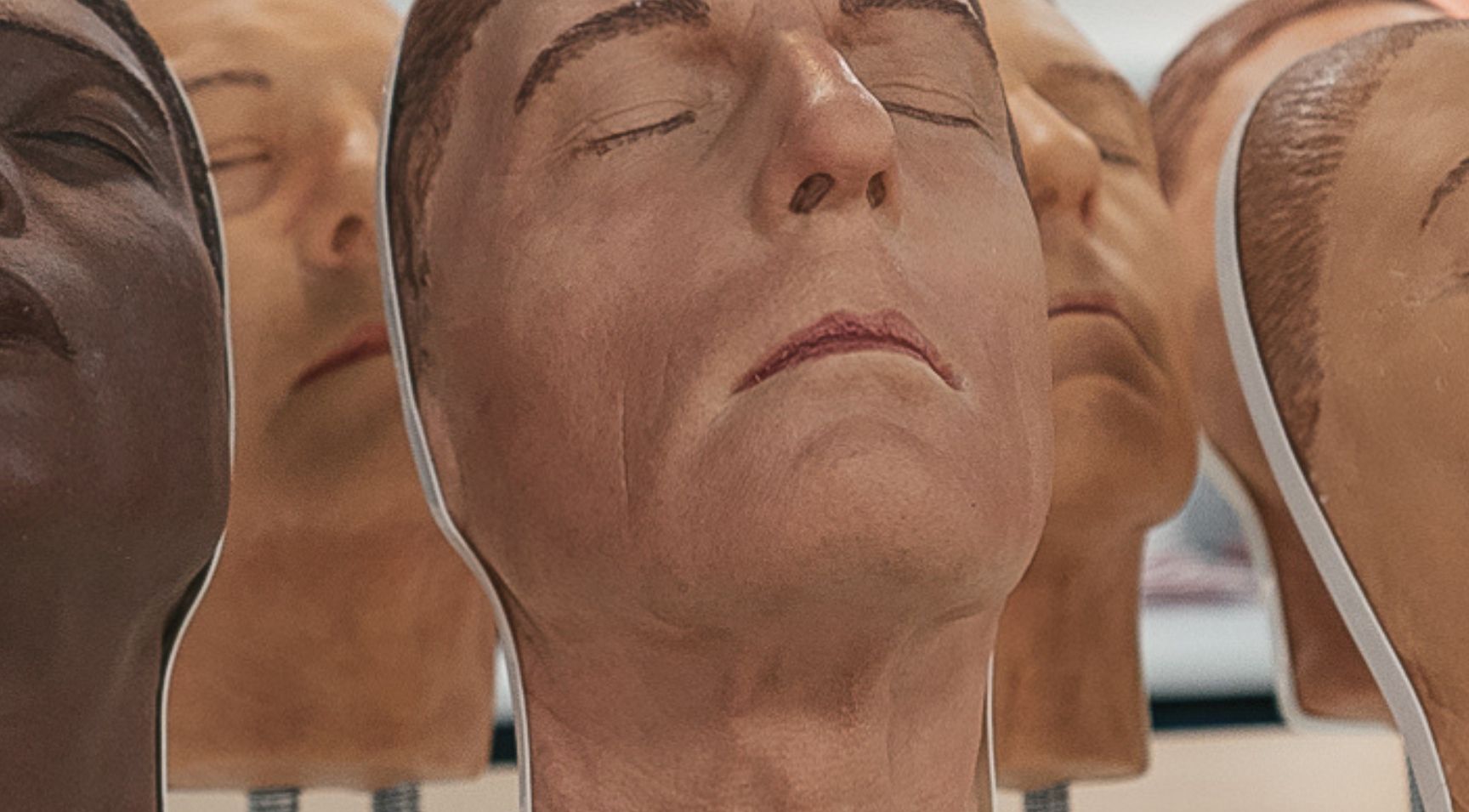 How to Treat Lines Filler Injection Techniques Harley Academy