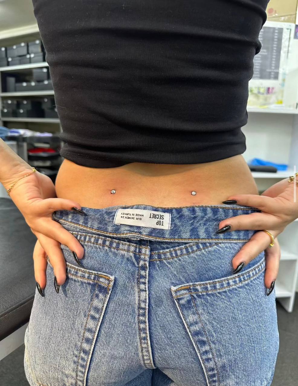 Back Dimple Microdermals