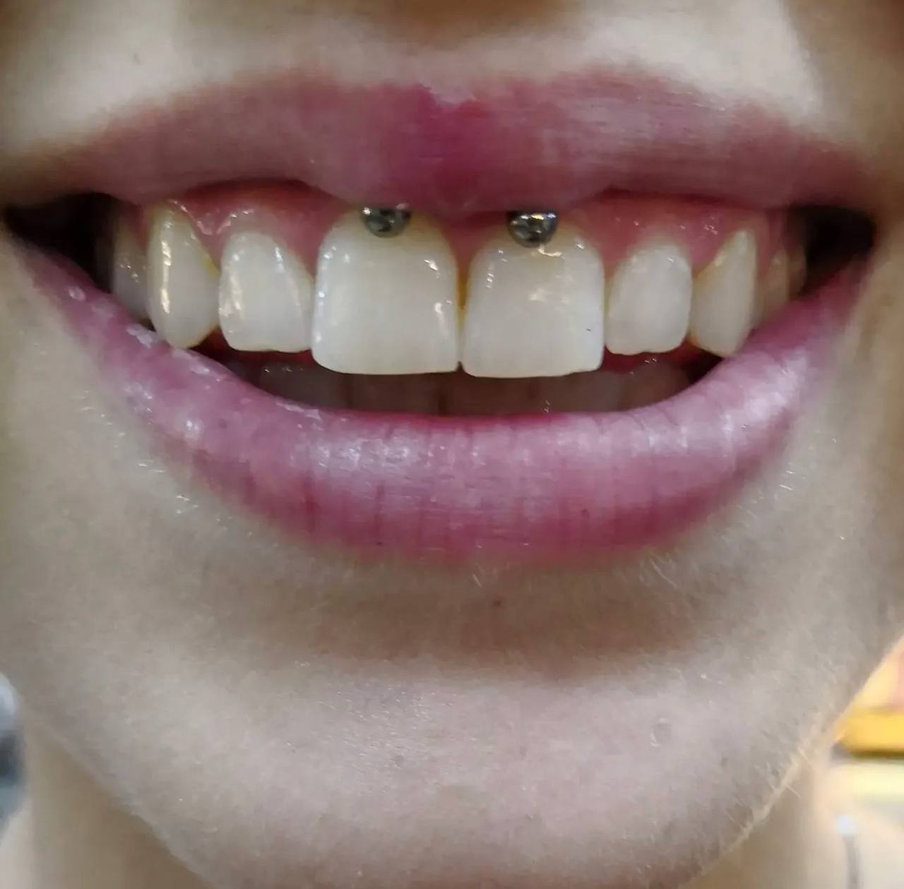 Smiley Frenulum Piercing
