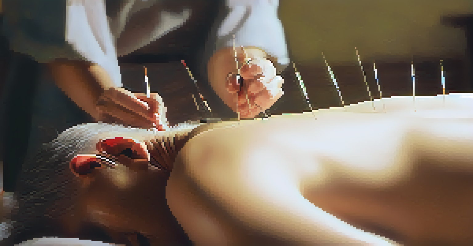 Close-up of a patient receiving acupuncture with needles inserted in their back.