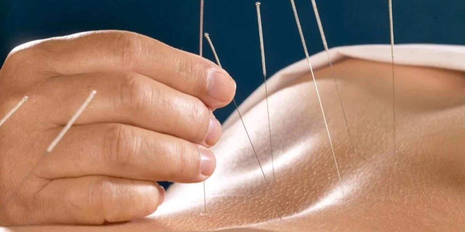 My Experience of Getting Acupuncture in Bangkok