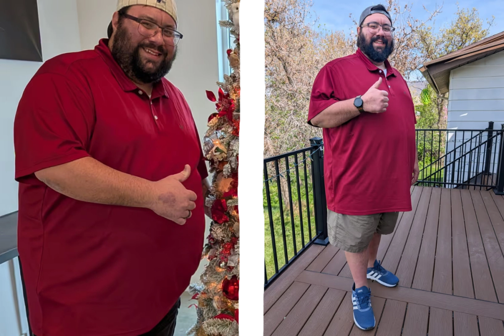 Patient transformation 10